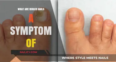 Ridged Nails: Uncovering Hidden Health Issues and Their Causes