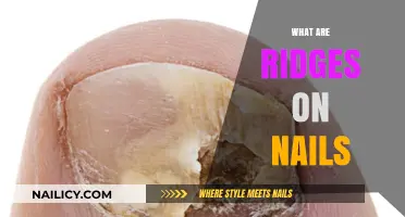 Understanding Nail Ridges: Causes, Concerns, and Care Tips Explained