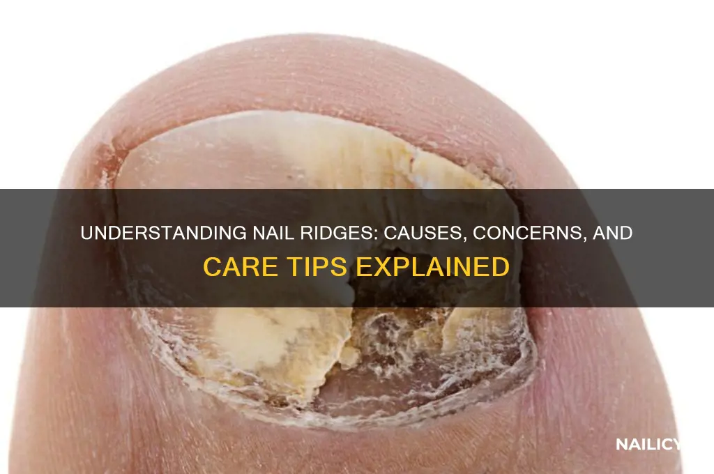 what are ridges on nails