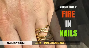 Understanding Nail Rings of Fire: Causes, Symptoms, and Treatment Options