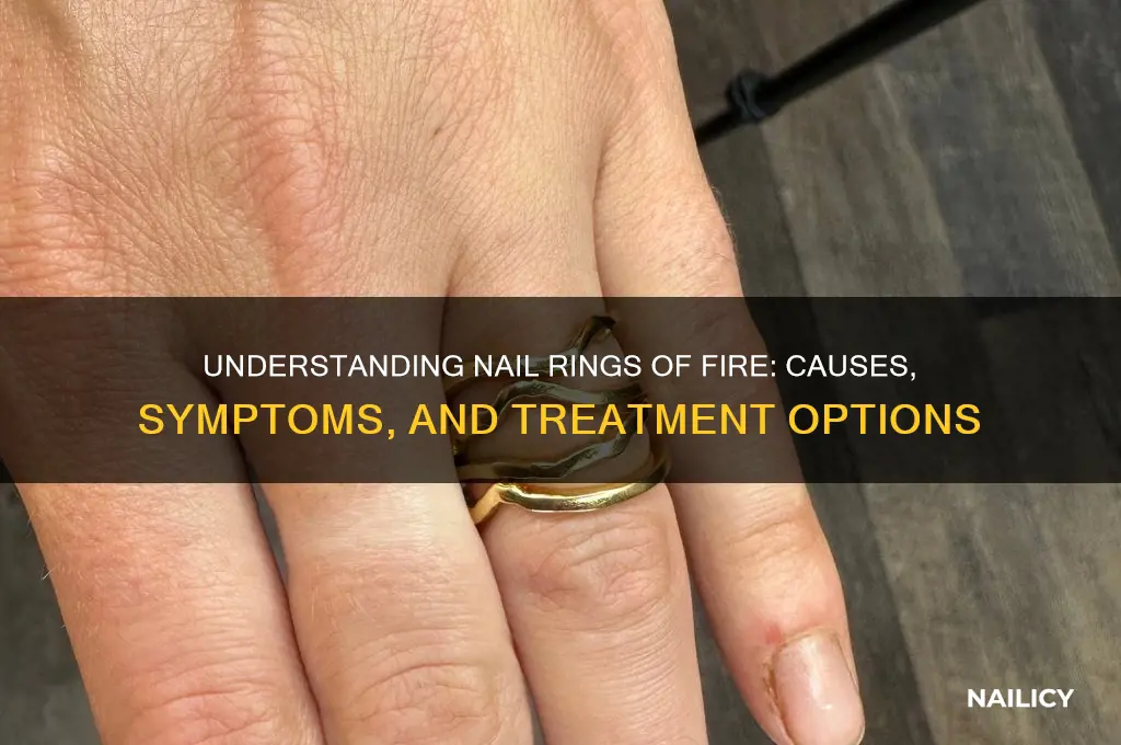 what are rings of fire in nails