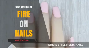 Understanding Nail Health: What Are Rings of Fire on Nails?