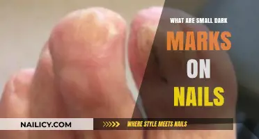 Small Dark Marks on Nails: Causes, Concerns, and Solutions Explained