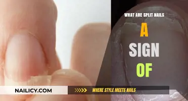 Split Nails: Uncovering Hidden Health Issues and Nutritional Deficiencies