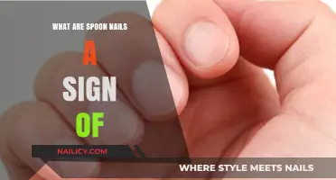 Spoon Nails: Uncovering Hidden Health Issues and Their Causes