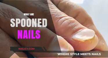 Understanding Spooned Nails: Causes, Symptoms, and Treatments