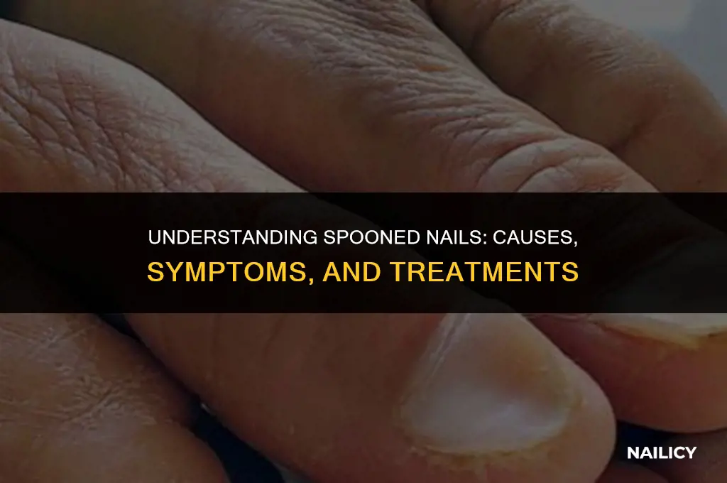 what are spooned nails
