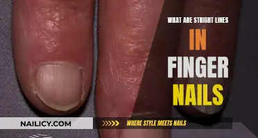 The Science of Straight Lines on Fingernails