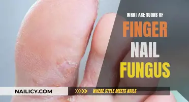 Recognizing Nail Fungus: Signs and Symptoms