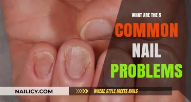 Common Nail Problems: 5 Issues to Watch For and Treat