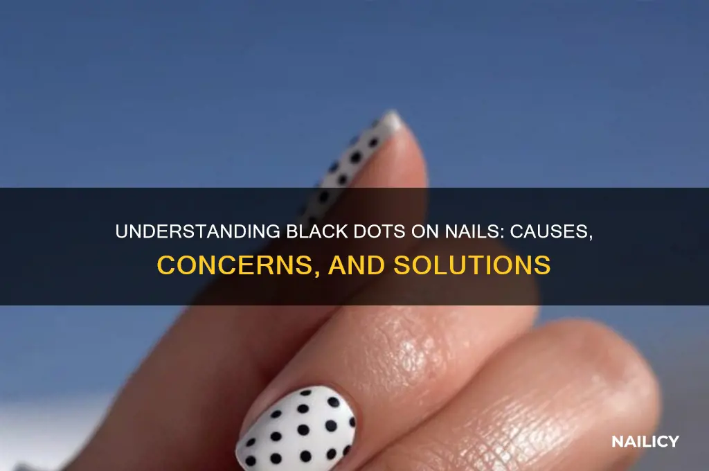 what are the black dots on my nails