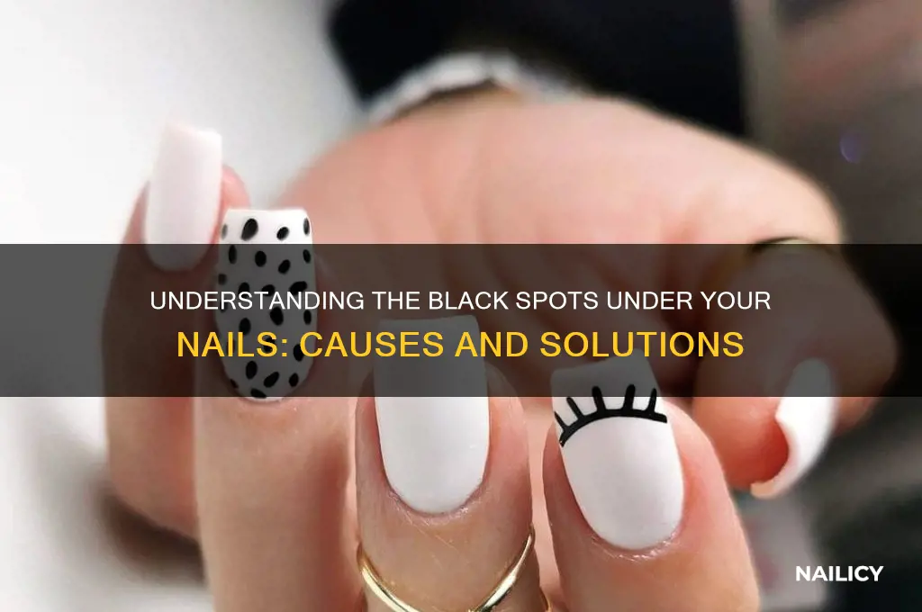 what are the black stuff in my nails