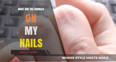 Understanding Nail Bubbles: Causes, Concerns, and Effective Solutions Explained