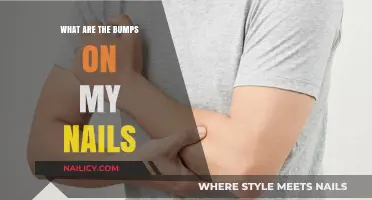 Understanding Nail Bumps: Causes, Concerns, and When to Seek Help