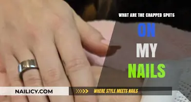Understanding Chapped Nail Spots: Causes, Prevention, and Effective Treatments