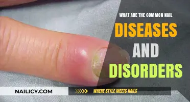 Understanding Common Nail Diseases and Disorders: Causes, Symptoms, and Treatments