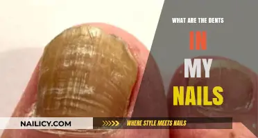 Understanding Nail Dents: Causes, Concerns, and When to Seek Help