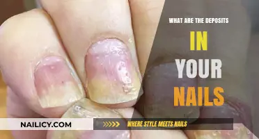 Understanding Nail Deposits: Causes, Types, and When to Seek Help