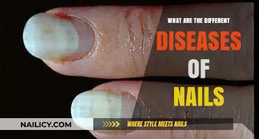 Understanding Common Nail Diseases: Symptoms, Causes, and Treatments
