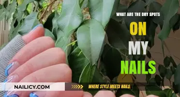 Dry Spots on Nails: Causes, Concerns, and Effective Solutions Explained