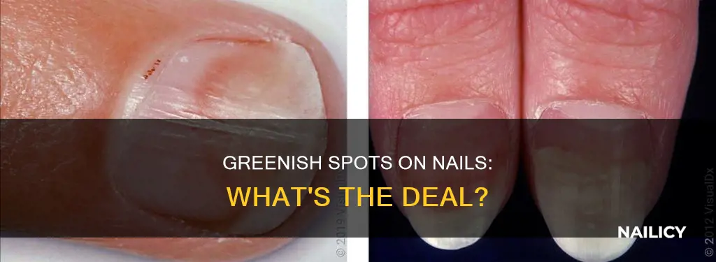 what are the greenish spots on my finger nails
