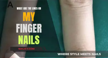 The Intriguing Lines on Fingernails: What Do They Mean?