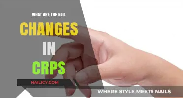 Understanding Nail Changes in CRPS: Symptoms, Causes, and Management Tips