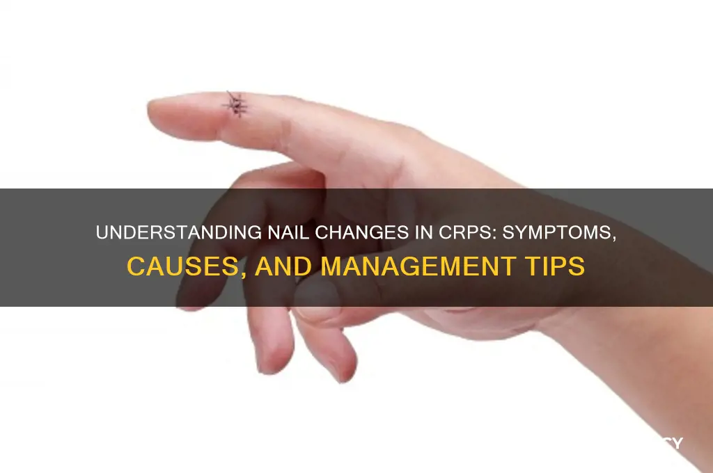 what are the nail changes in crps
