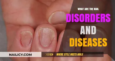 Understanding Common Nail Disorders and Diseases: Causes, Symptoms, and Treatments