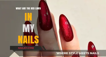 Understanding Red Lines in Nails: Causes, Concerns, and Solutions
