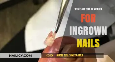 Effective Remedies for Ingrown Nails: Relief and Prevention Tips