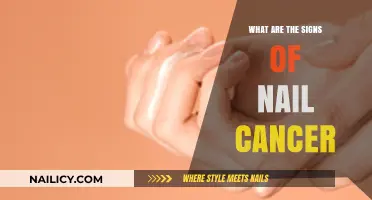 Recognizing Nail Cancer: Key Symptoms and Early Warning Signs