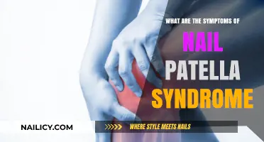 Understanding Nail Patella Syndrome: Key Symptoms and Early Signs Explained