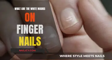 White Marks on Fingernails: What Do They Mean?