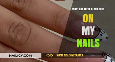 Black Dots on Nails: Causes, Concerns, and Quick Solutions Explained