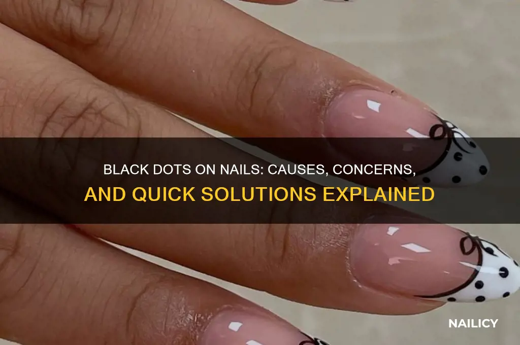 what are these black dots on my nails