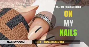 Black Lines on Nails: Causes, Concerns, and When to Seek Help