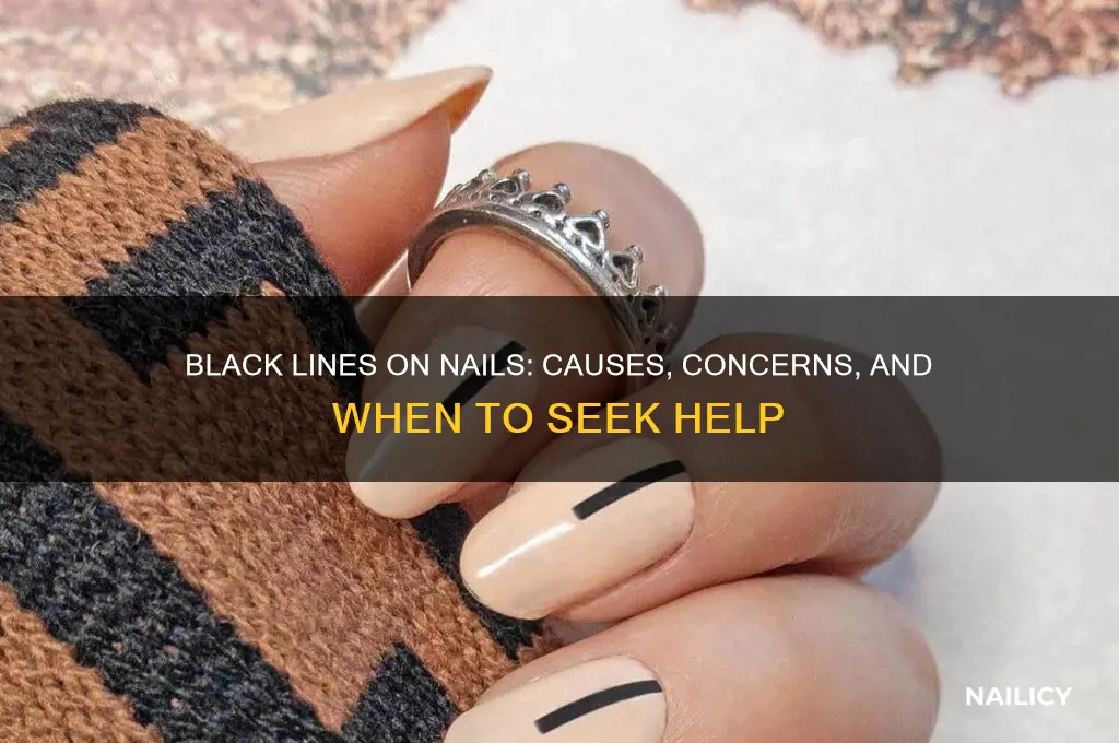 what are these black lines on my nails