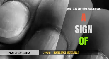 Vertical Nail Ridges: Uncovering Hidden Health Clues and Causes