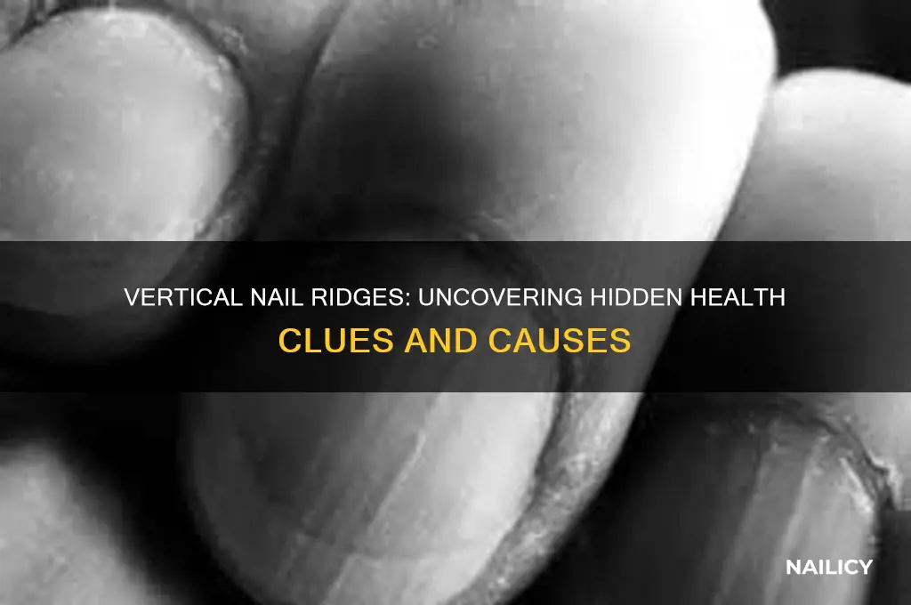 what are vertical nail ridges a sign of
