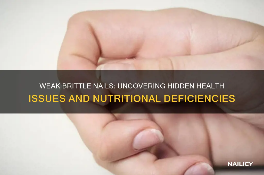 what are weak brittle nails a sign of