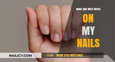 Understanding White Spots on Nails: Causes, Concerns, and Solutions