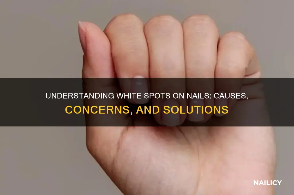 what are wite spots on my nails
