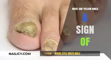 Yellow Nails: Uncovering Hidden Health Issues and Possible Causes