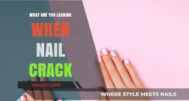 Cracked Nails? Uncover the Nutrient Deficiencies Behind Brittle Nails