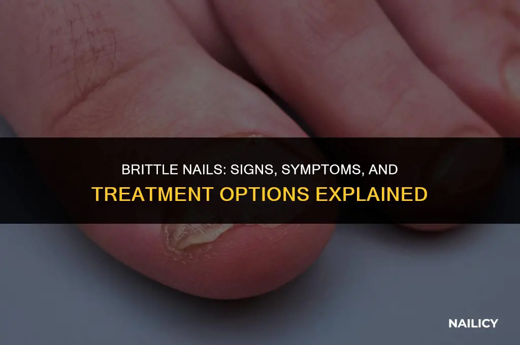 what brittle nails look like