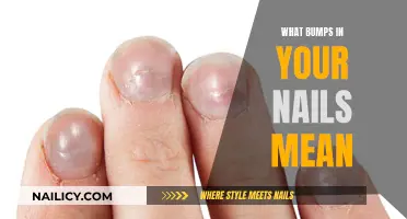 Unraveling the Mystery: Nail Bumps and Their Meanings