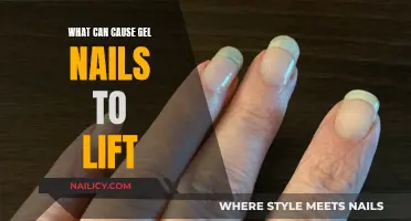 Gel Nails Lifting: What Are the Common Causes?
