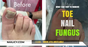 Best Products to Treat Toenail Fungus
