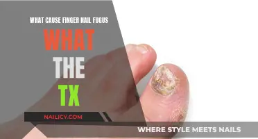 Fighting Nail Fungus: Causes and Treatment Options